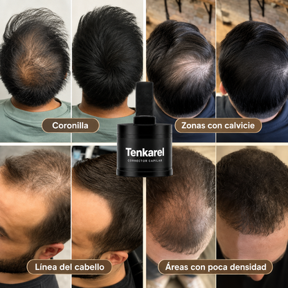 Tenkarel Corrector Capilar
