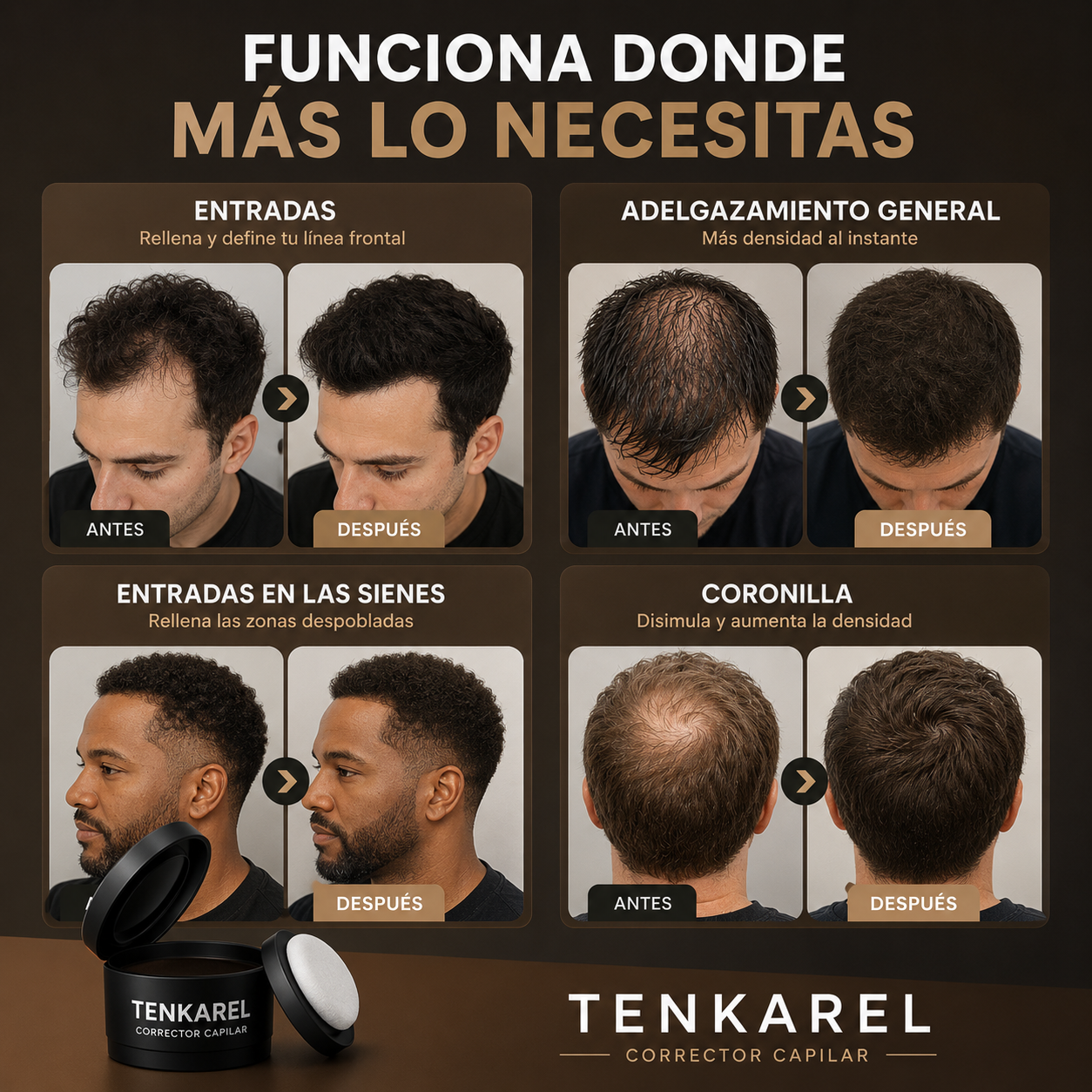 Tenkarel Relleno Para Aumentar la Densidad Capilar