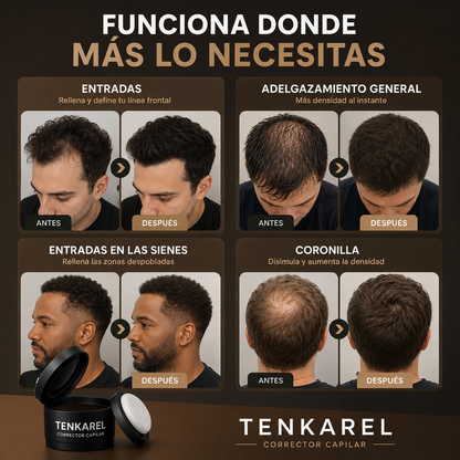 Tenkarel Relleno Para Aumentar la Densidad Capilar