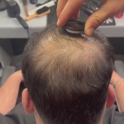 Tenkarel Corrector Capilar